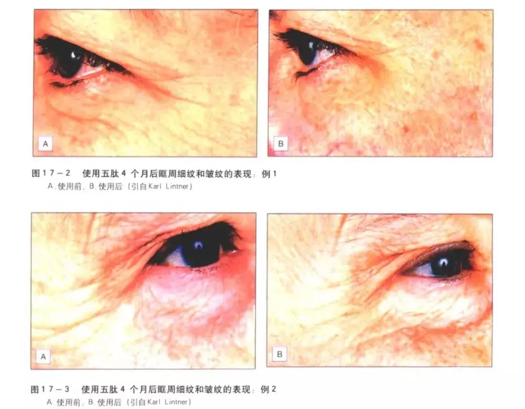 抗老抗皱纹的护肤品是真的吗,胜肽真的抗老么