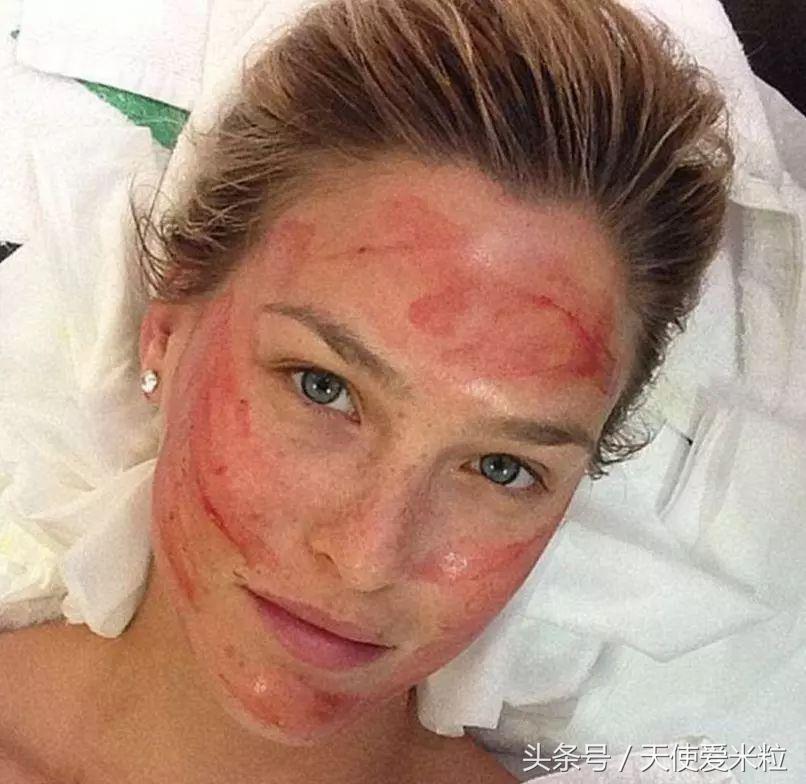 最新的整形塑形手术,7种整形手术可以尝试