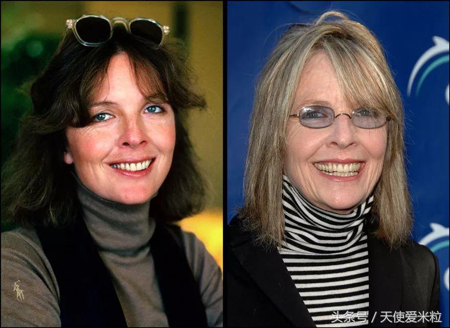 最新的整形塑形手术,7种整形手术可以尝试