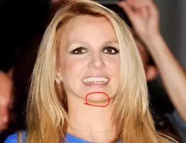 怎样化解双下巴,ps双下巴是怎么减下去的