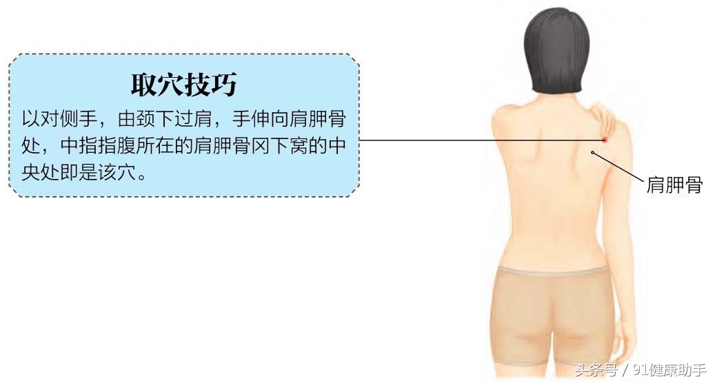 穴位肩周炎,肩井穴天宗穴疼痛女性