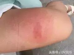 成千上万飞蚁密集来袭！千万不能这样做，否则后果很严重