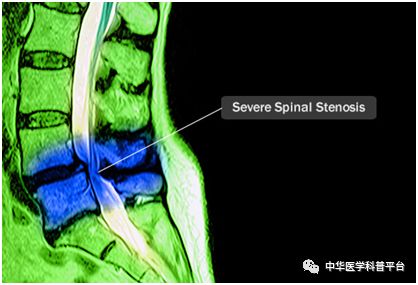 腰背部疼痛什么原因引起的,腰上背部疼痛是什么原因
