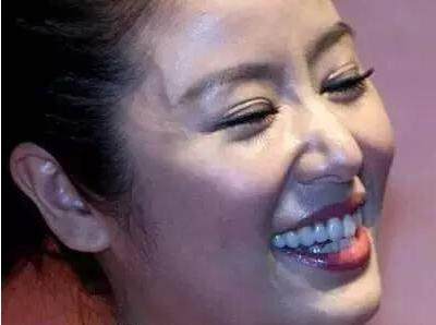 被双眼皮贴坑了的女星们,明星双眼皮李小璐