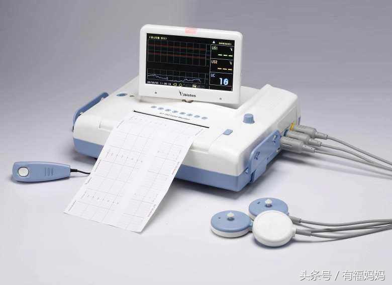 怎么样才能产检都一次性过呢,怎么做产检才免费