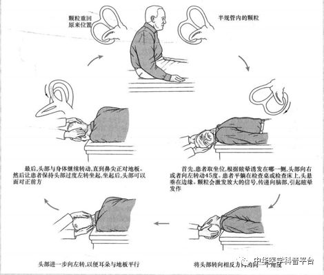天旋地转的晕叫什么病,天旋地转的晕是什么原因引起的