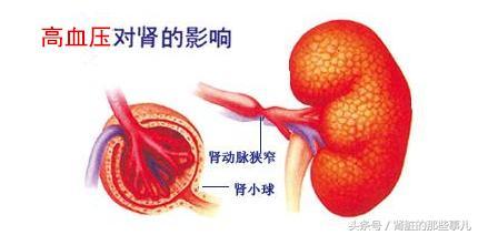 得了高血压要如何避免对肝肾损伤,得了高血压怎样吃降压药