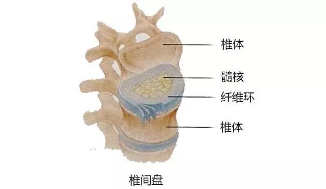 腰椎间盘突出压迫神经怎么治最好,腰椎间盘突出和生活过度有关吗