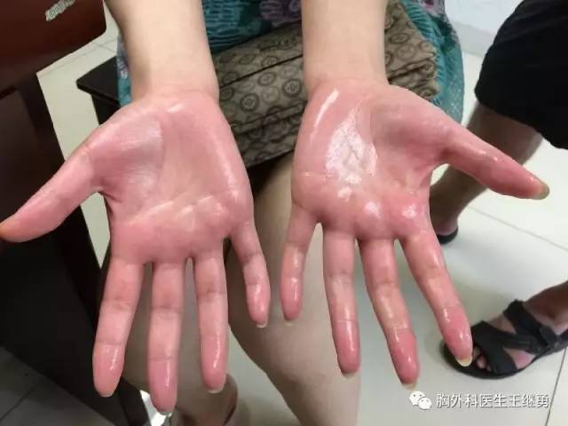 医生说我这个病没法治只能自愈,医生说治不了怎么办