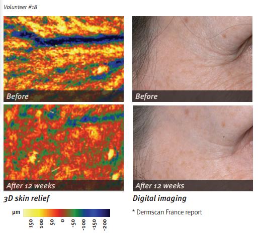 sesderma西班牙焕白果酸身体乳,西班牙美白身体乳sesderma好粘