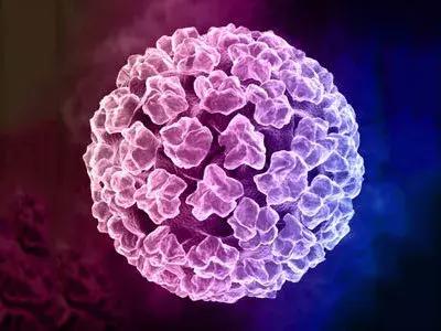 得了尖锐性湿疣到底怎样才能治好,尖锐性湿疣病的克星