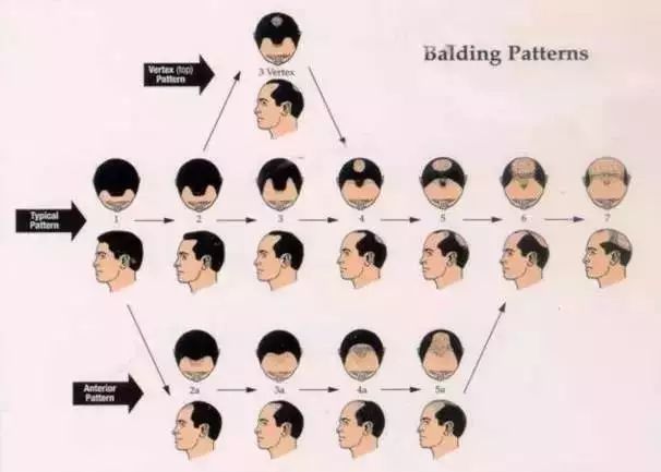 脱发难题100道,脱发题