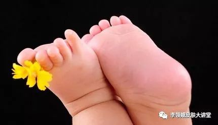 「杏林微科普」真假“香港脚”