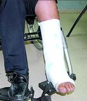 可笑又可怕，为了运毒，他们连小丁丁都不放过