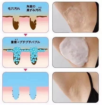 叙好物｜夏天也想做香气飘飘的小仙女？光知道止汗喷雾可不够