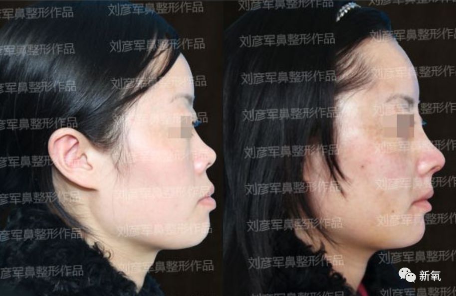 迪丽热巴被p图事件回应,迪丽热巴被p图的视频