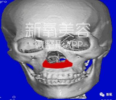 迪丽热巴被p图事件回应,迪丽热巴被p图的视频