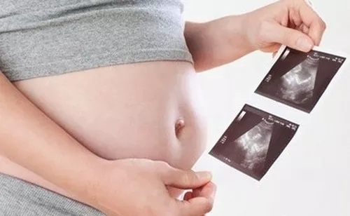 四维彩超有必要做吗,四维彩超刻盘有必要吗