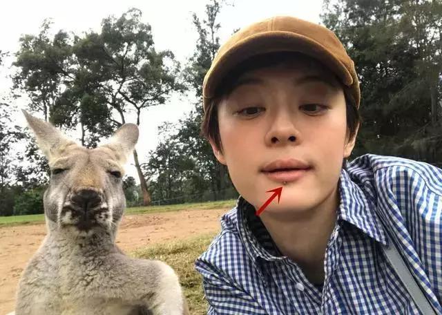 孙俪嘴唇下这颗痣怎越变越大？被网友质疑颜值，终于公开这个原因
