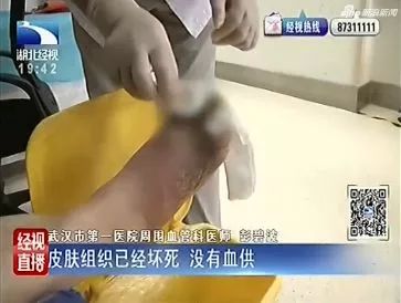 女儿为妈妈治脚气,女儿用84消毒液给妈妈洗脚