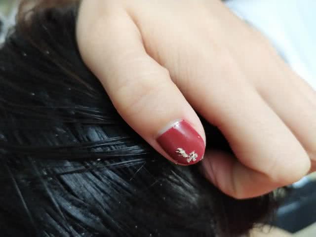 学会这6招家里再也没有螨虫,怎样才能把头上的螨虫弄下来