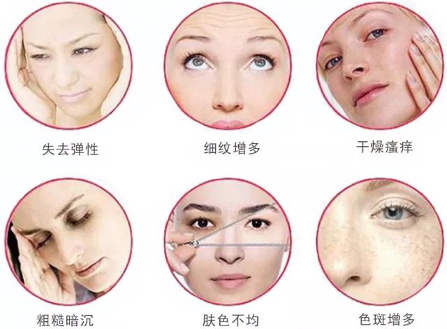不打针就能有效去皱纹的产品,不用打针就能去皱的产品