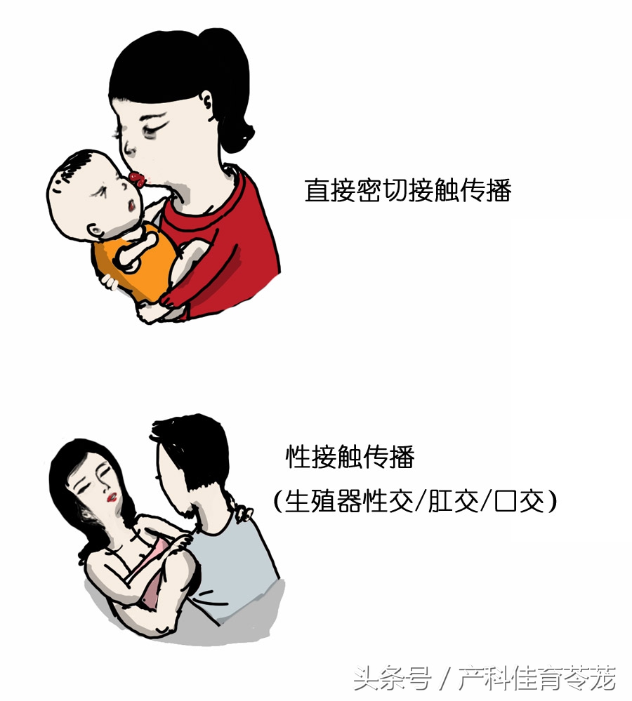 小孩感染单纯疱疹危险吗,1型与2型单纯疱疹病毒感染区别