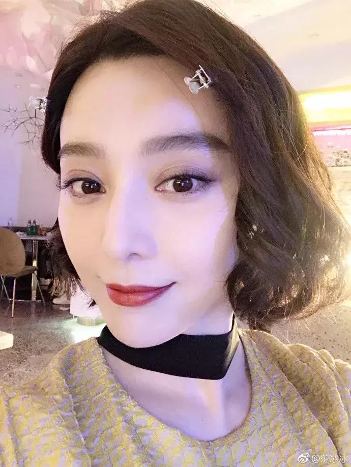 林允暴瘦照片,林允腿上的淤青原因