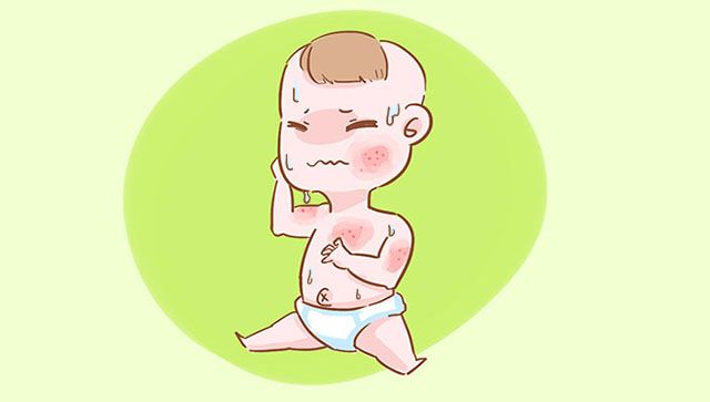宝宝夜里睡不好老是闹人,宝宝一睡觉湿疹就加重