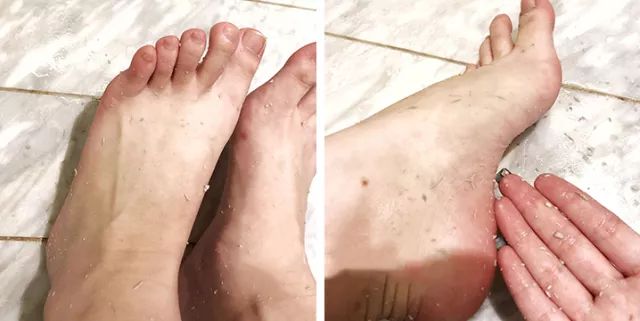 精致鞋护理,护理去死皮