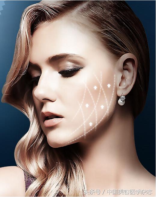 做完线雕为啥不到1月感觉脸垮掉,线雕之后脸会不会垮掉