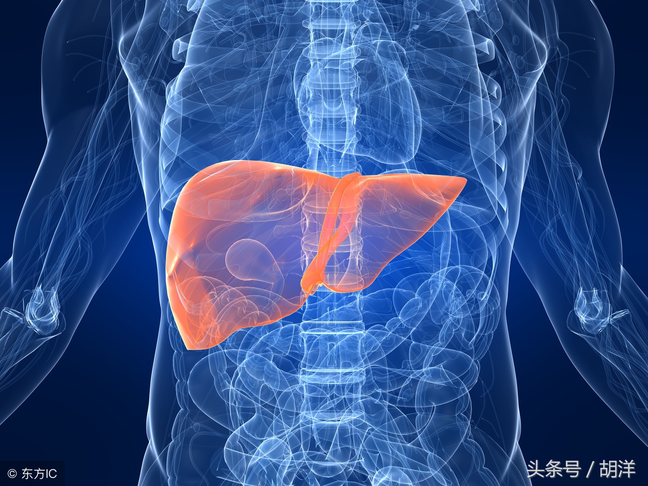 有肿瘤是否肿瘤标志物一定会偏高,肿瘤标志物ca125与什么有关