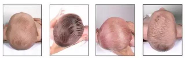 宝宝睡圆头平躺要睡多久,5个月宝宝头睡平了还能圆回来吗