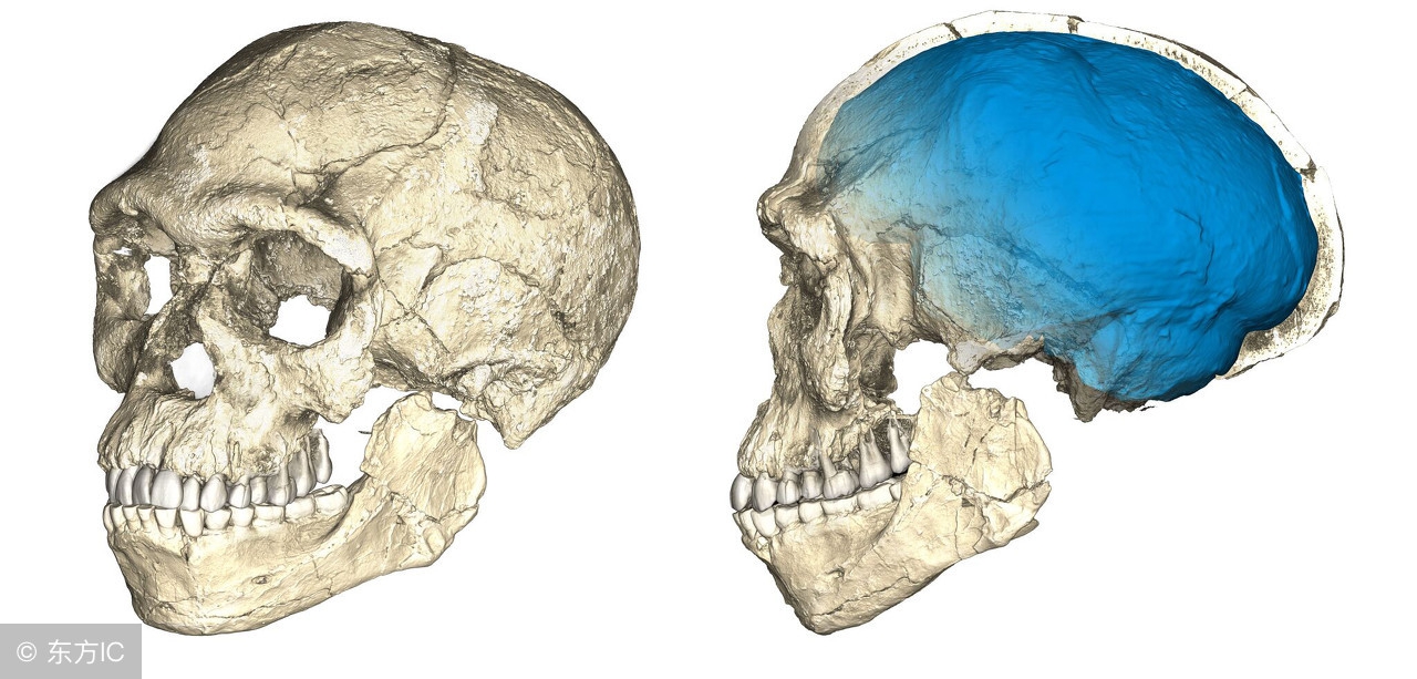 脑外伤去骨瓣后多久才能补骨头,脑外伤颅骨骨折吃什么