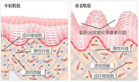 浅谈面部五层提升为什么能更好的解决面部松弛下垂