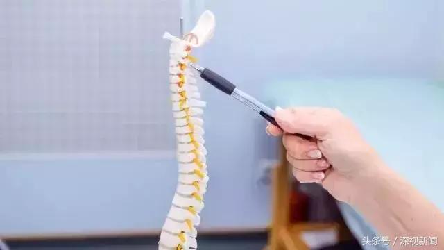 国家青少年脊柱侧弯免费救助文件,脊柱侧弯可以领多少补助