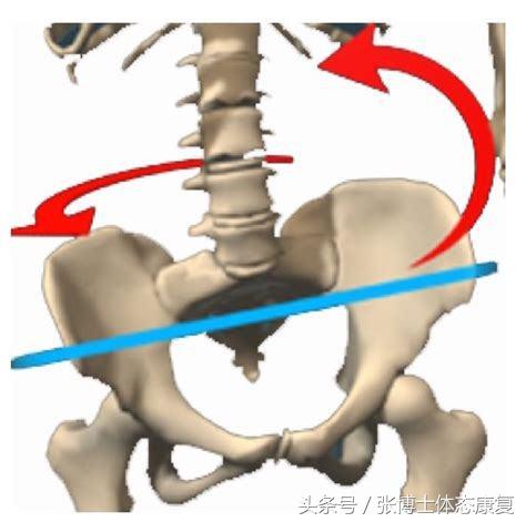 矫正长短腿去哪里矫正,体态矫正腿