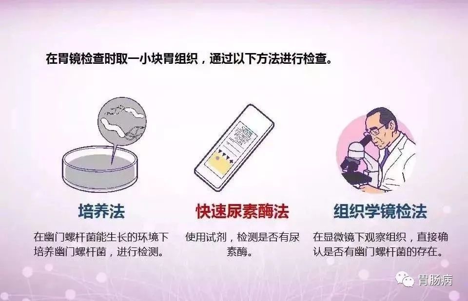 幽门螺杆菌HP什么意思,hp幽门螺杆菌的症状