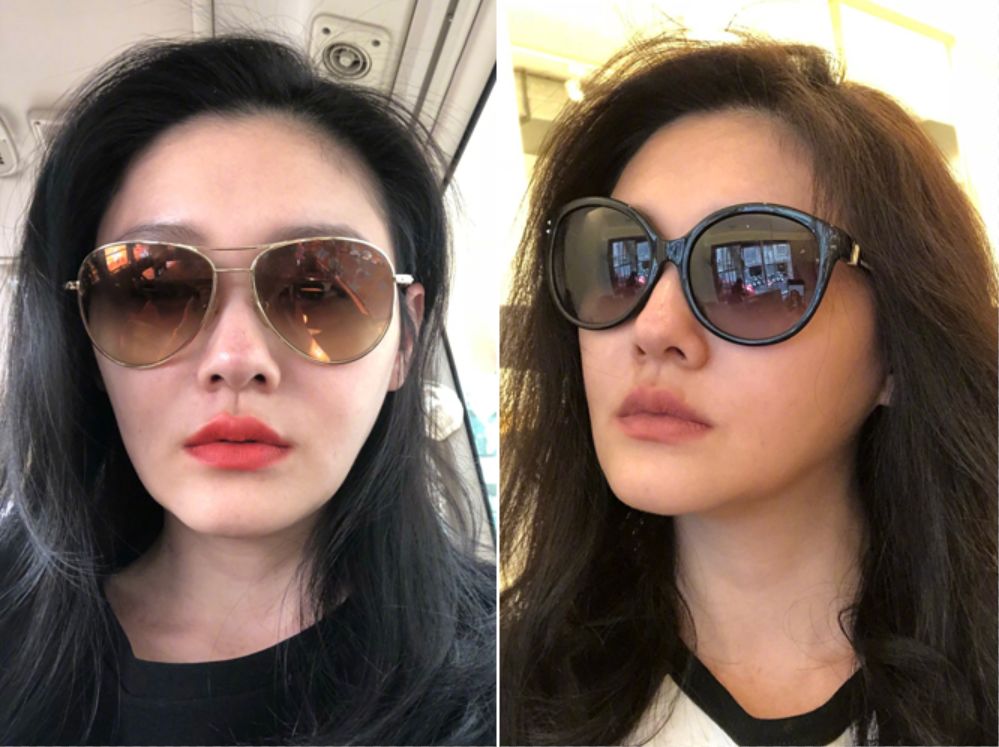 大s吃抗凝血剂美白视频,大s吃抗凝血剂美白多少钱