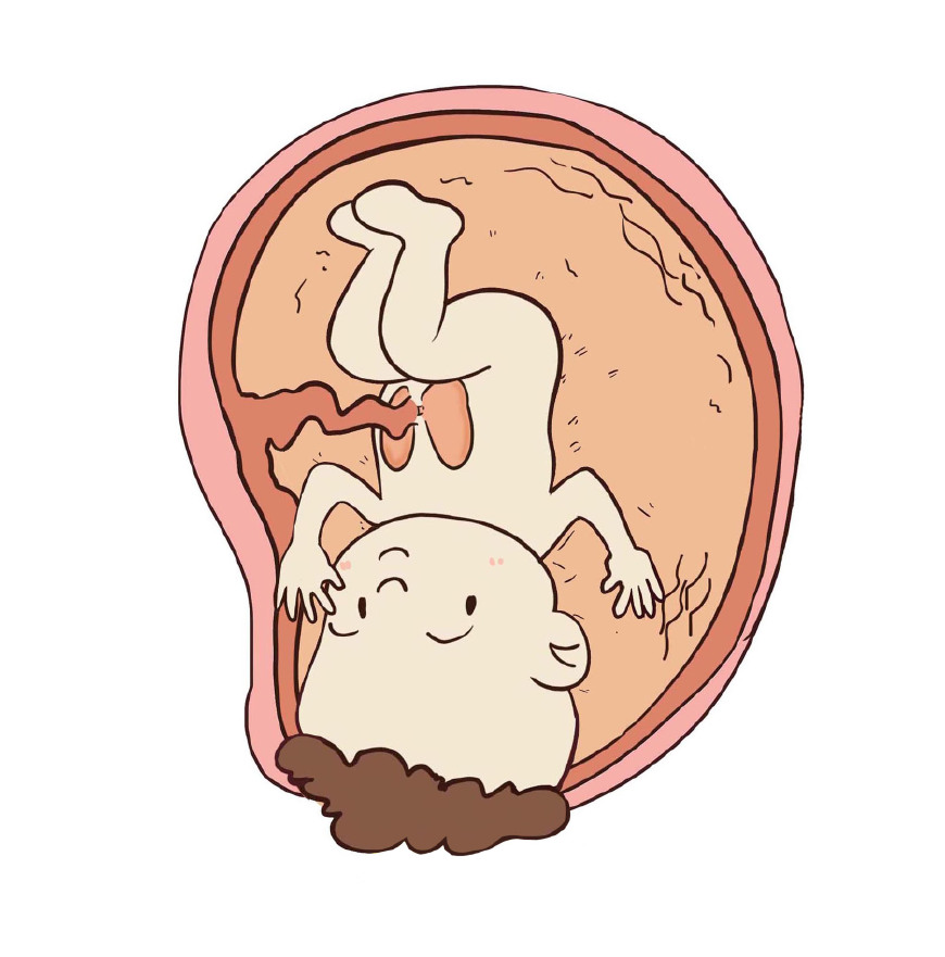 孕晚期准妈妈的产前关注事项,孕早期准妈妈要做的事