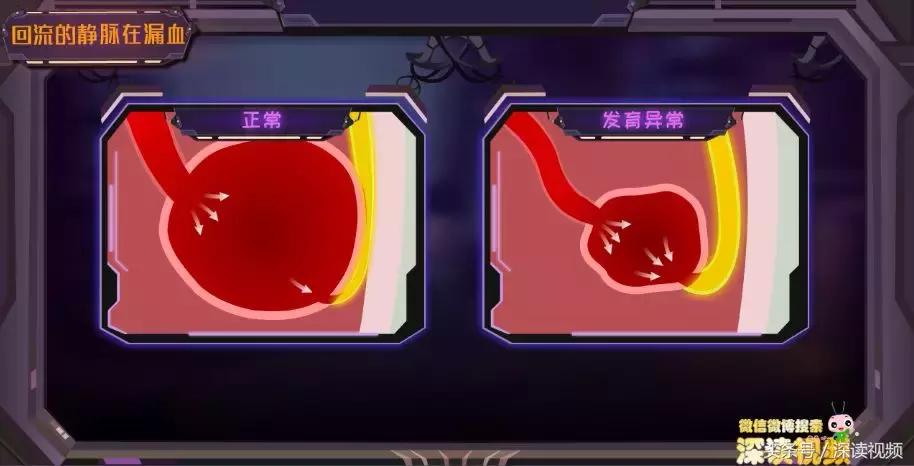 谁让你“兄弟”不给力，谁让你“痿”靡不振？阳痿真凶都在这啦！