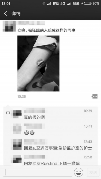 护士拿小孩插管痛苦撕心裂肺,护士看着病人疼痛难忍