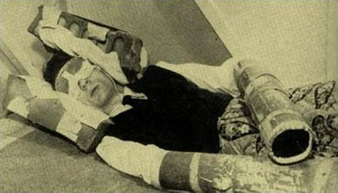 黑暗治疗要暗抗吗,黑暗治疗术