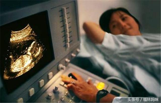 b超看胎儿能不能发现双胞胎,b超看双胞胎准吗