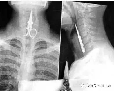 这些奇葩的X光片，看得整个人有点不自在！