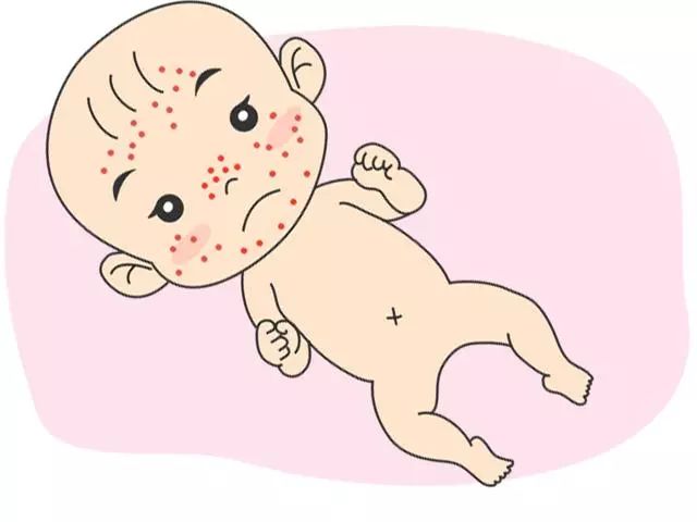 宝宝皮肤出现问题,解决春夏皮肤问题的好方法是什么