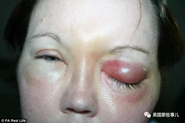 戴着隐形眼镜洗了一次澡,戴了隐形眼镜晚上还是看不清楚