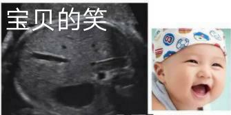 顺产的子宫为什么要流血,顺产后子宫有血怎么办