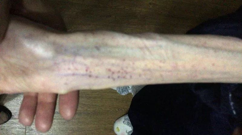 1米58从120到100斤减肥成功案例,1米6370斤减肥成功案例
