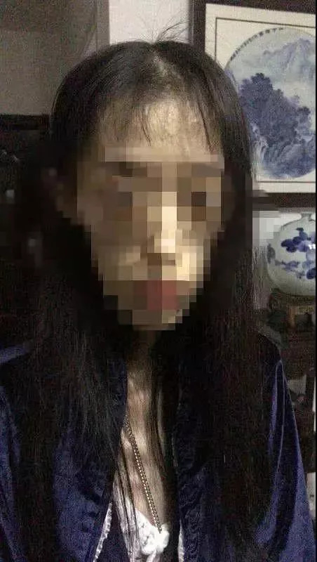 21岁女孩自杀式减肥只剩50斤，差点变成植物人！照片不忍直视